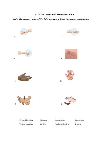 Bleeding and soft tissue injuries