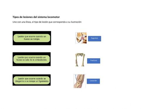 Lesiones en el sistema locomotor