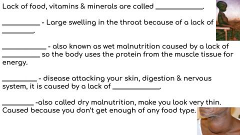 Types of malnutrition