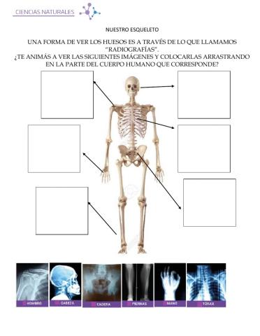 Mi esqueleto