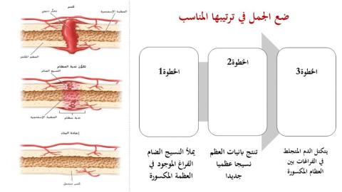 الجهاز الهيكلي - 6