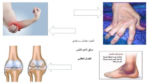 الجهاز الهيكلي - 10