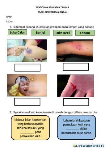Kecederaan ringan (tahun 3)