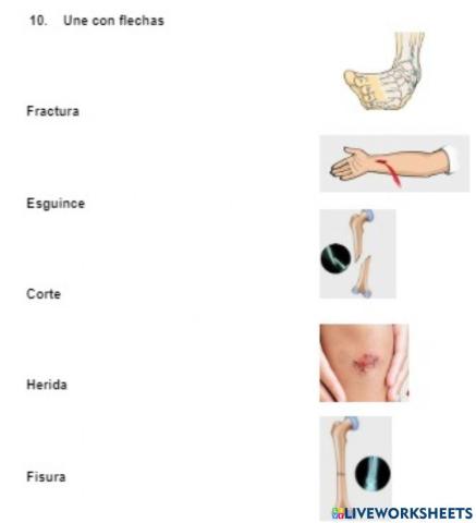 Fracturas, fisuras, esguince.