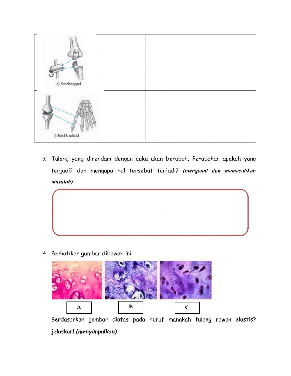 Sistem gerak (tulang-peretemuan 1) kelas xi mia 3