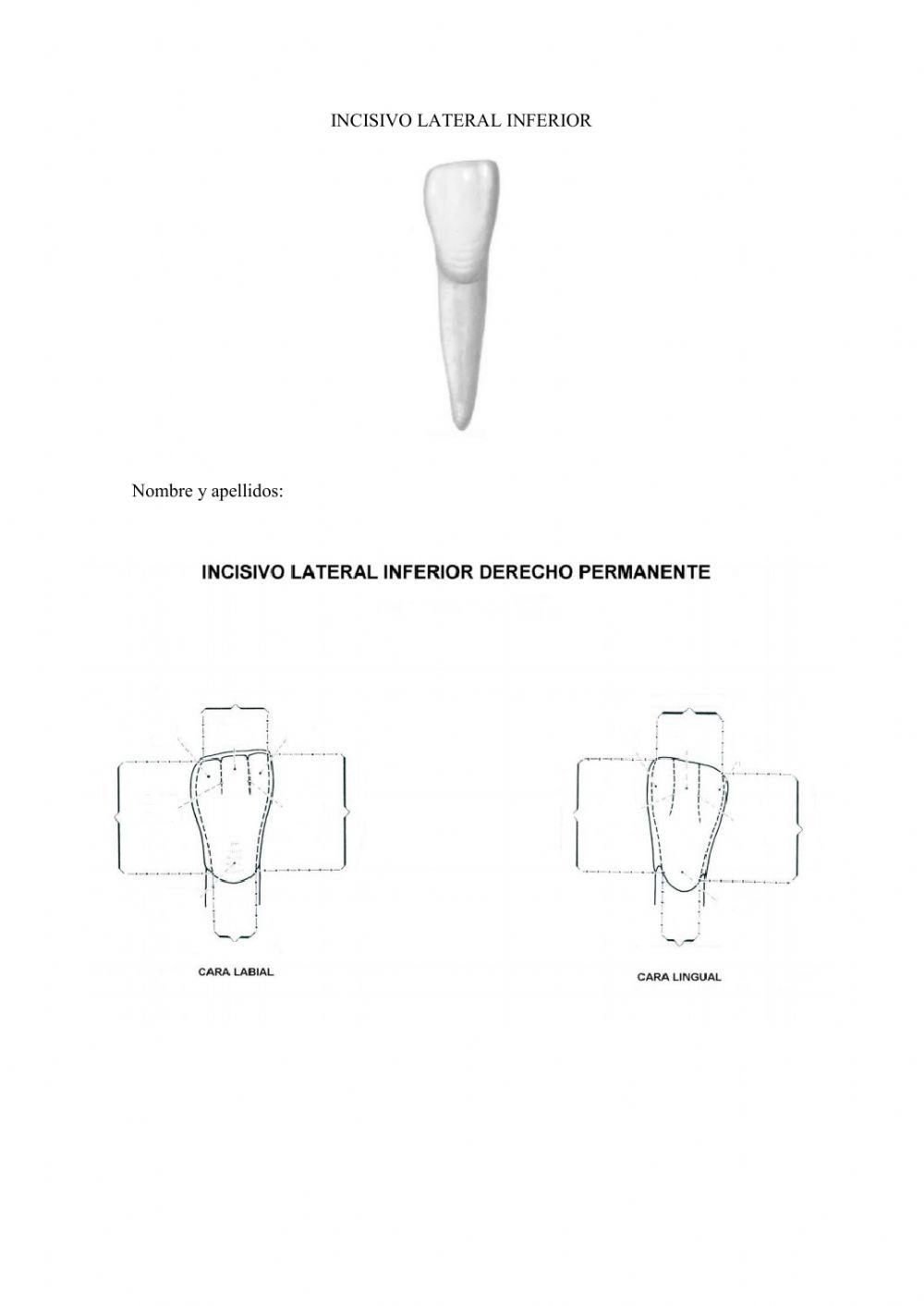 incisivo lateral