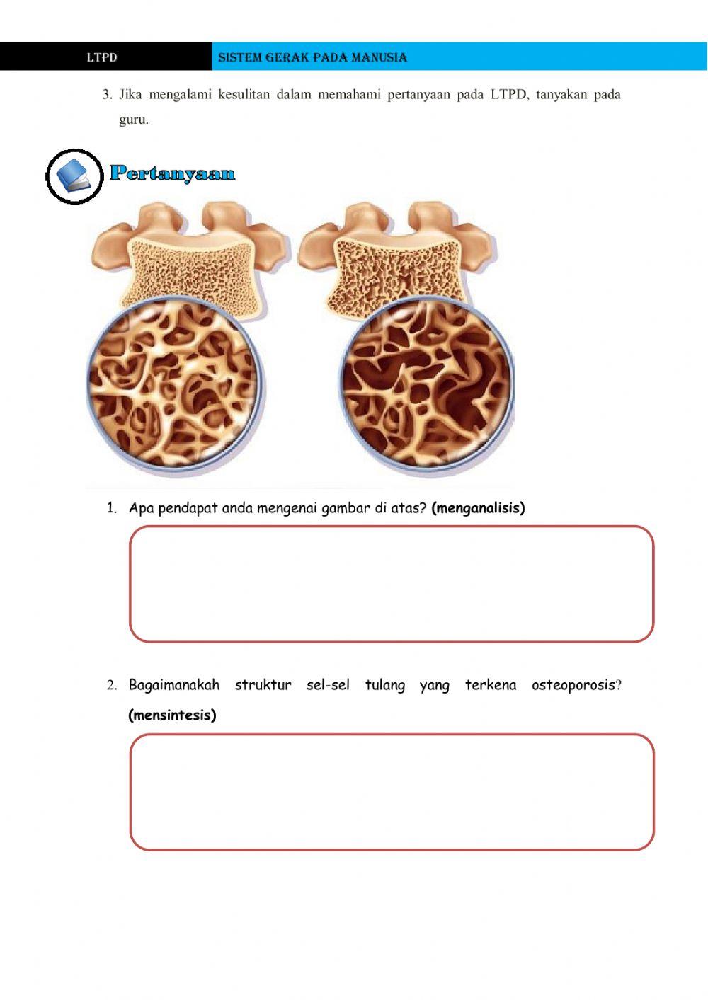 Sistem gerak (Kelainan pada tulang dan otot) Kelas XI MIA 1