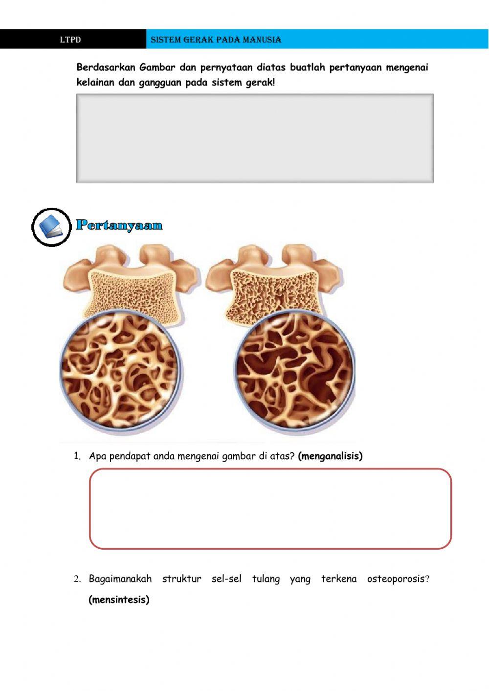Sistem gerak (Kelainan pada tulang dan otot) Kelas XI MIA 3