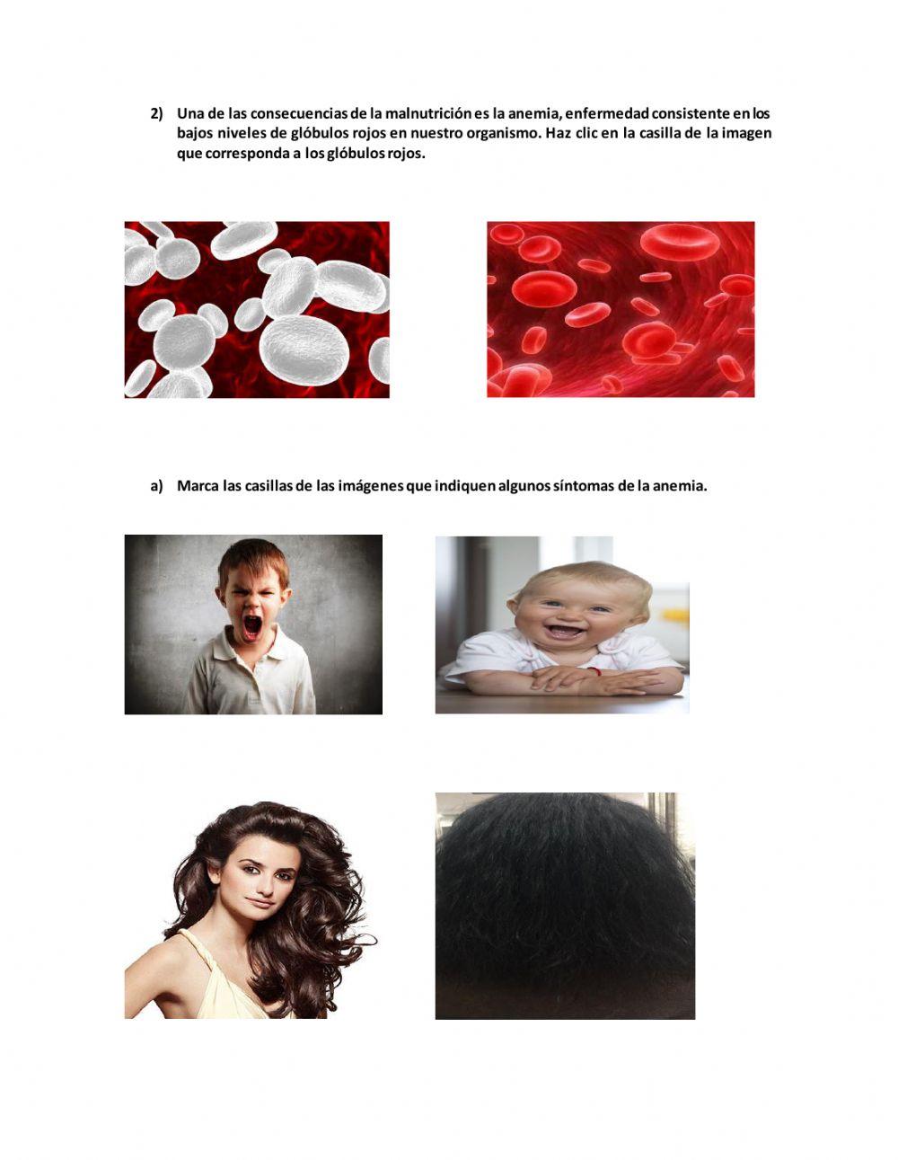 Consecuencias de una mala alimentación