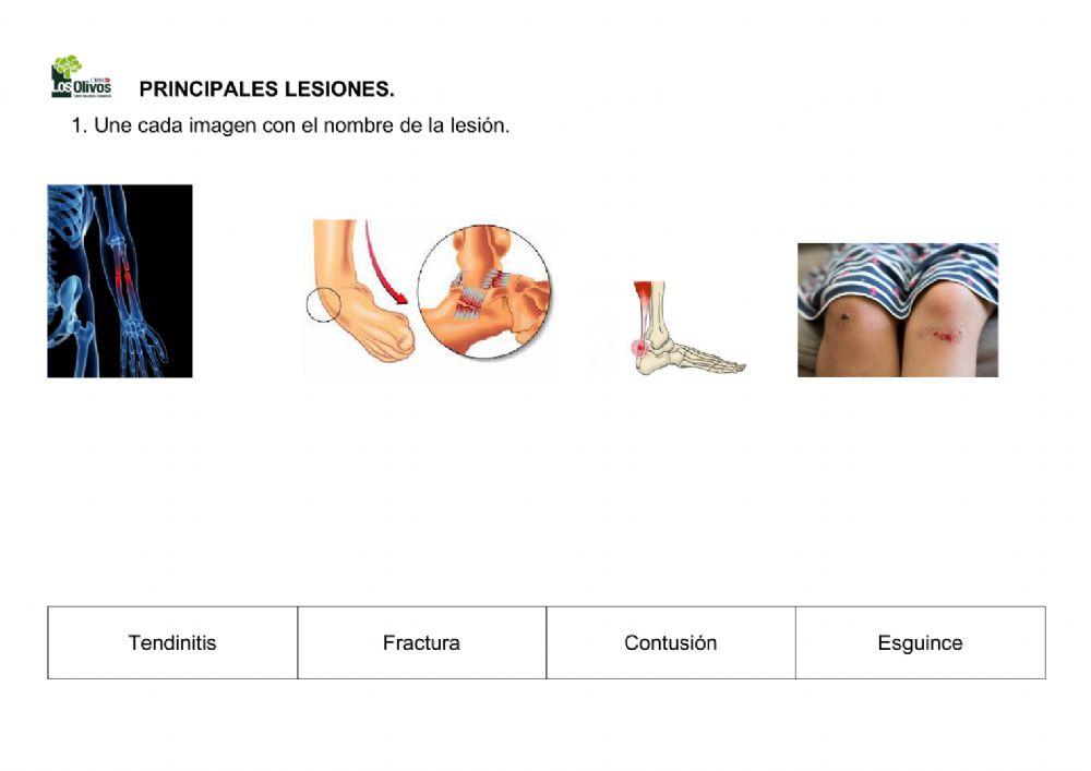 Lesiones