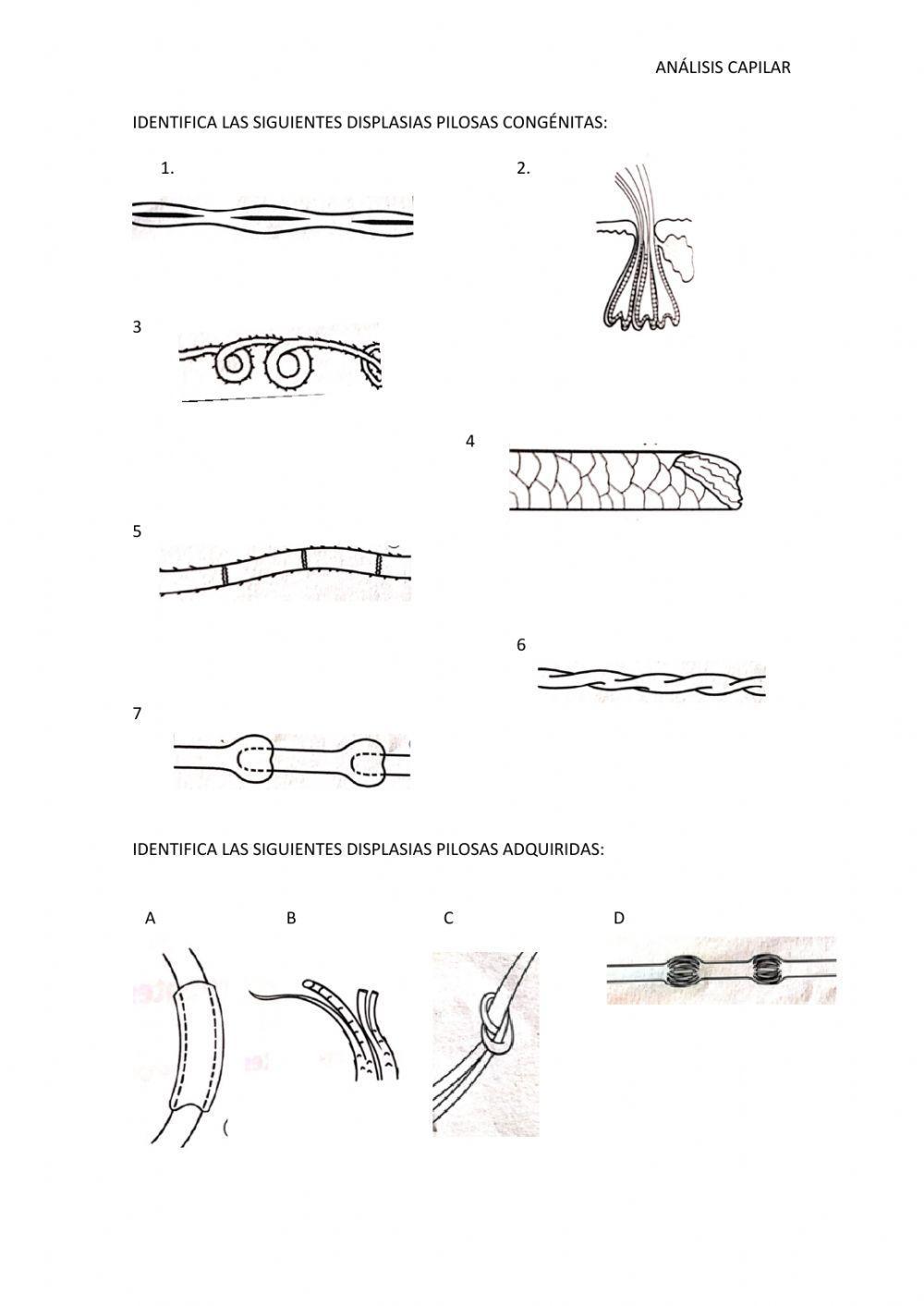 Alteraciones capilares