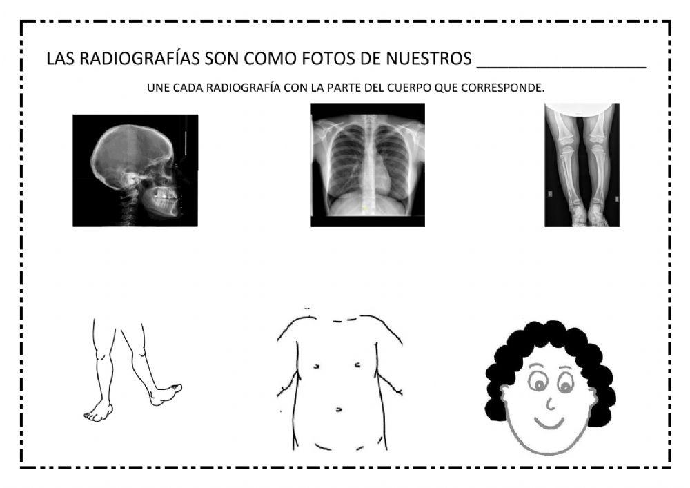 Unir radiografías y parte del cuerpo