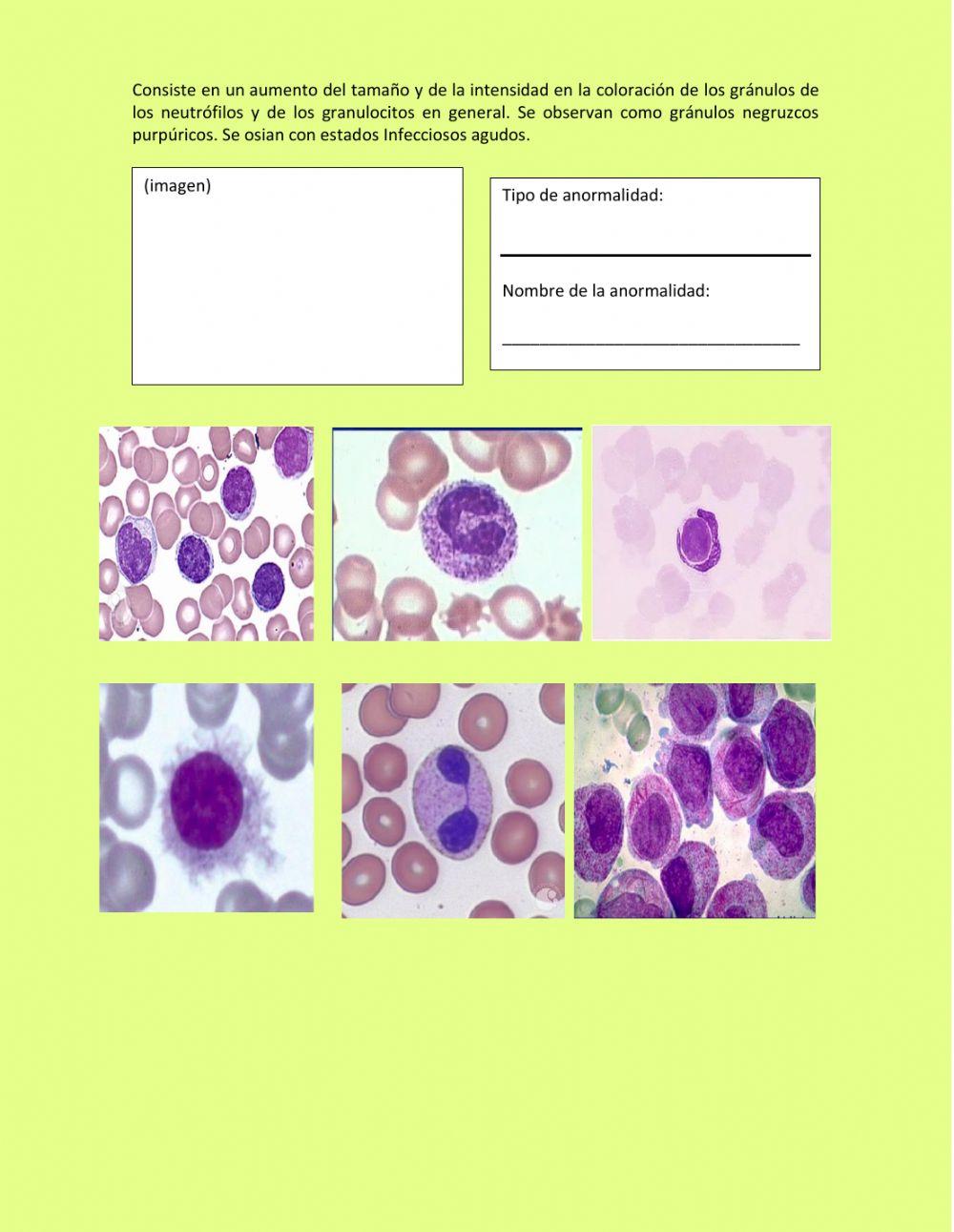 Anormalidades leucocitarias