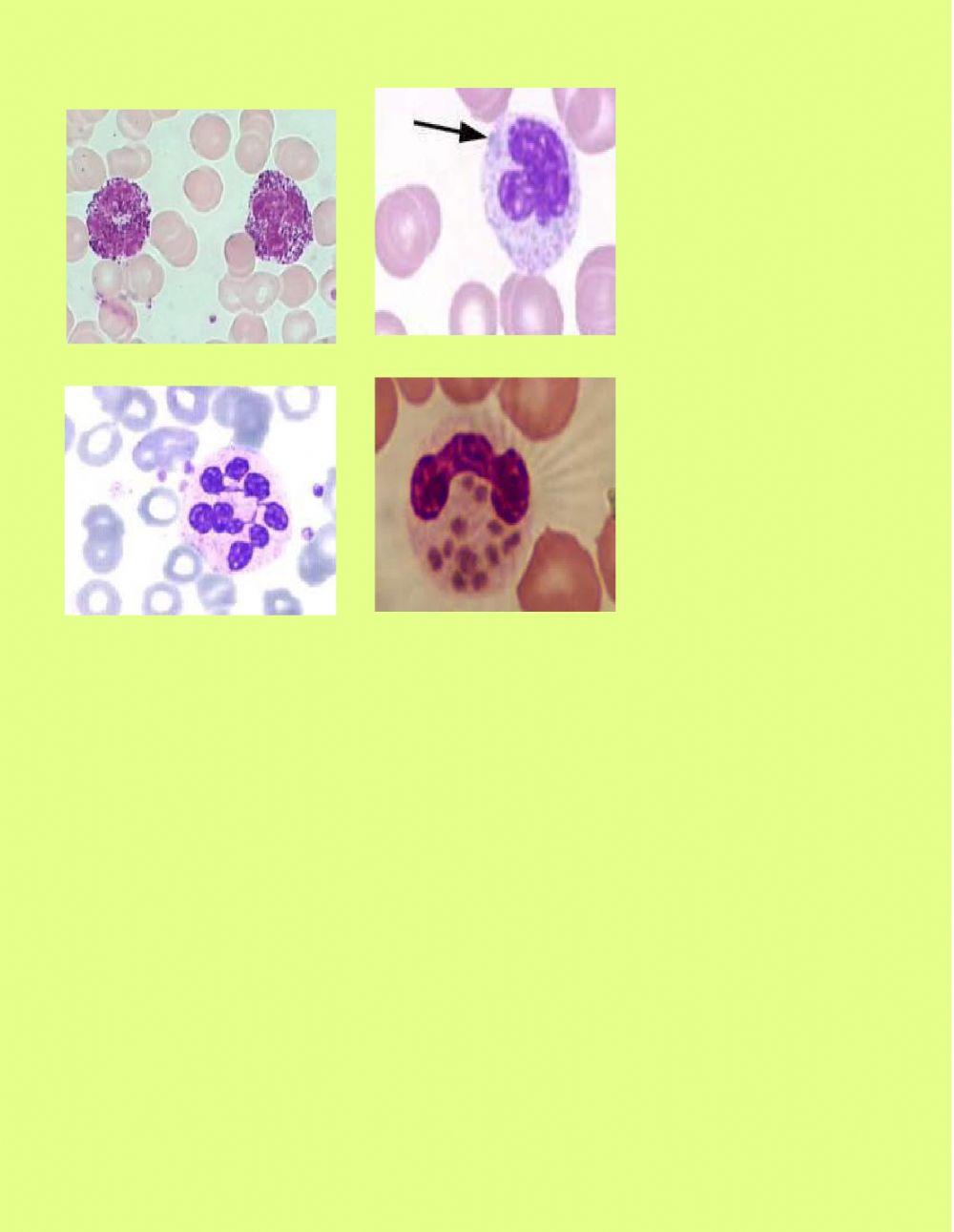 Anormalidades leucocitarias