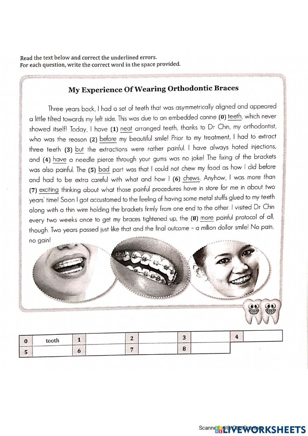 My Experience of Wearing Orthodontic Braces