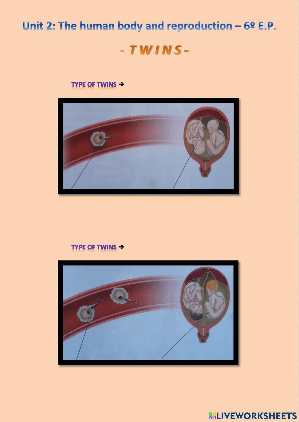 1686815 | Twins | MIGUEL | LiveWorksheets