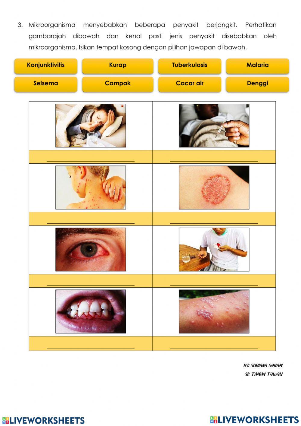 2.2 Kesan Buruk dan Faedah Mikroorganisma
