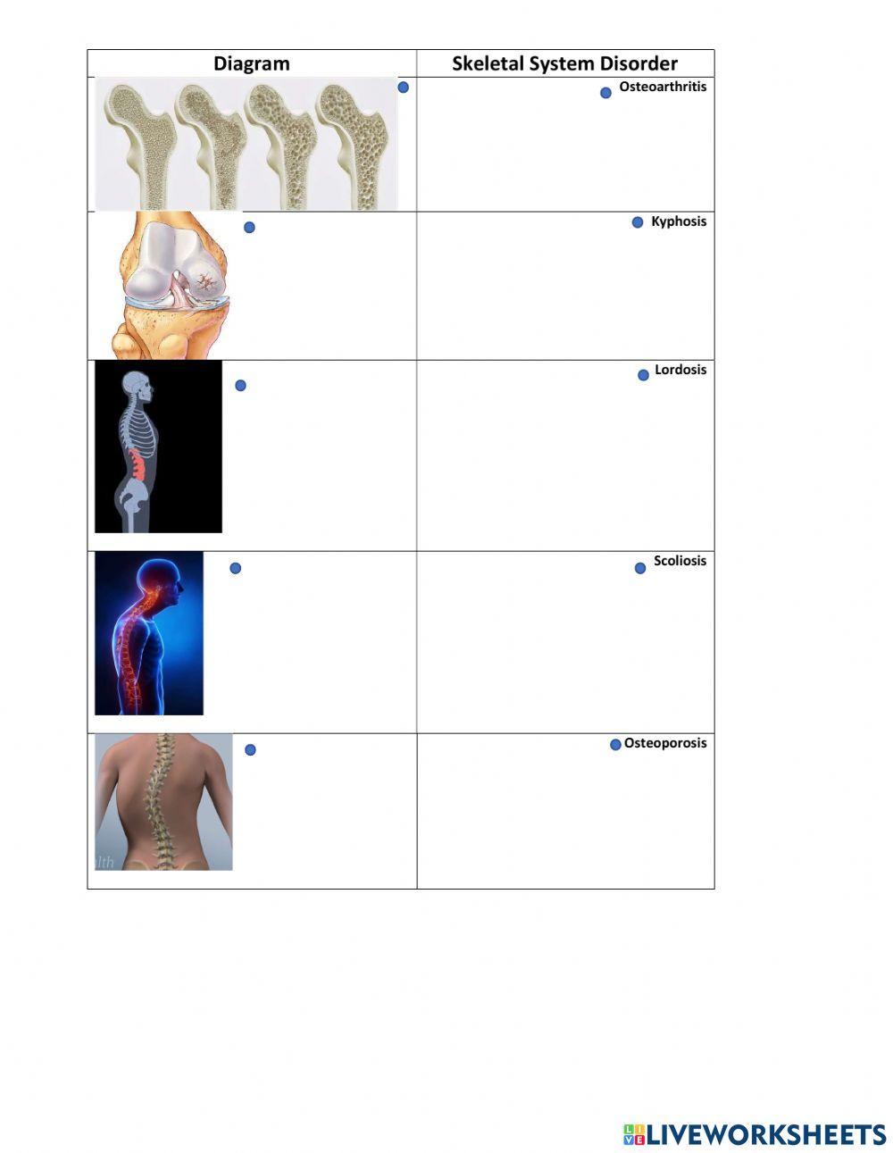 Skeletal system Disorder