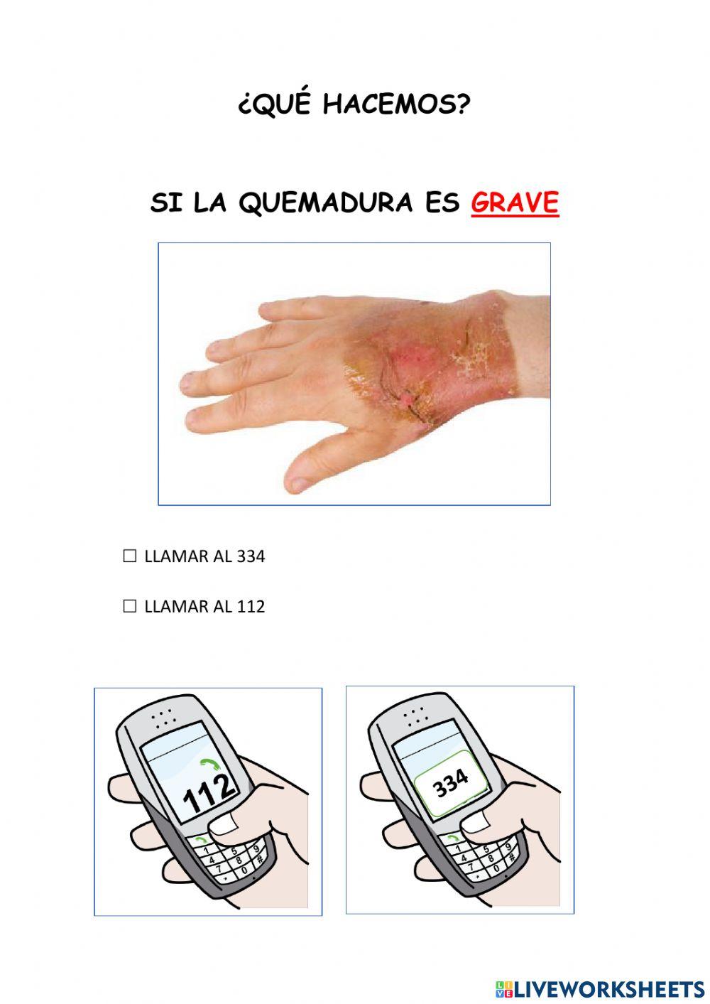 Protocolo ante quemaduras