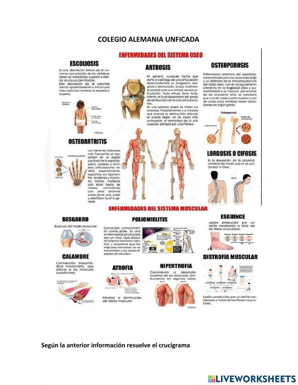 Enfermedades sistema oseo