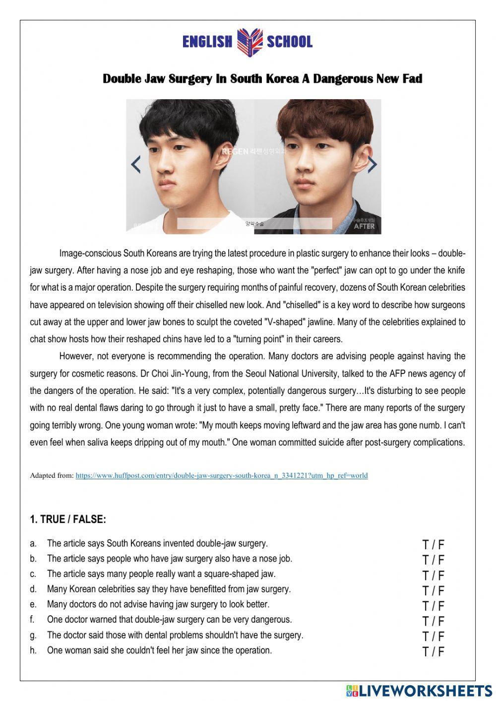 Double Jaw Surgery In South Korea A Dangerous New Fad