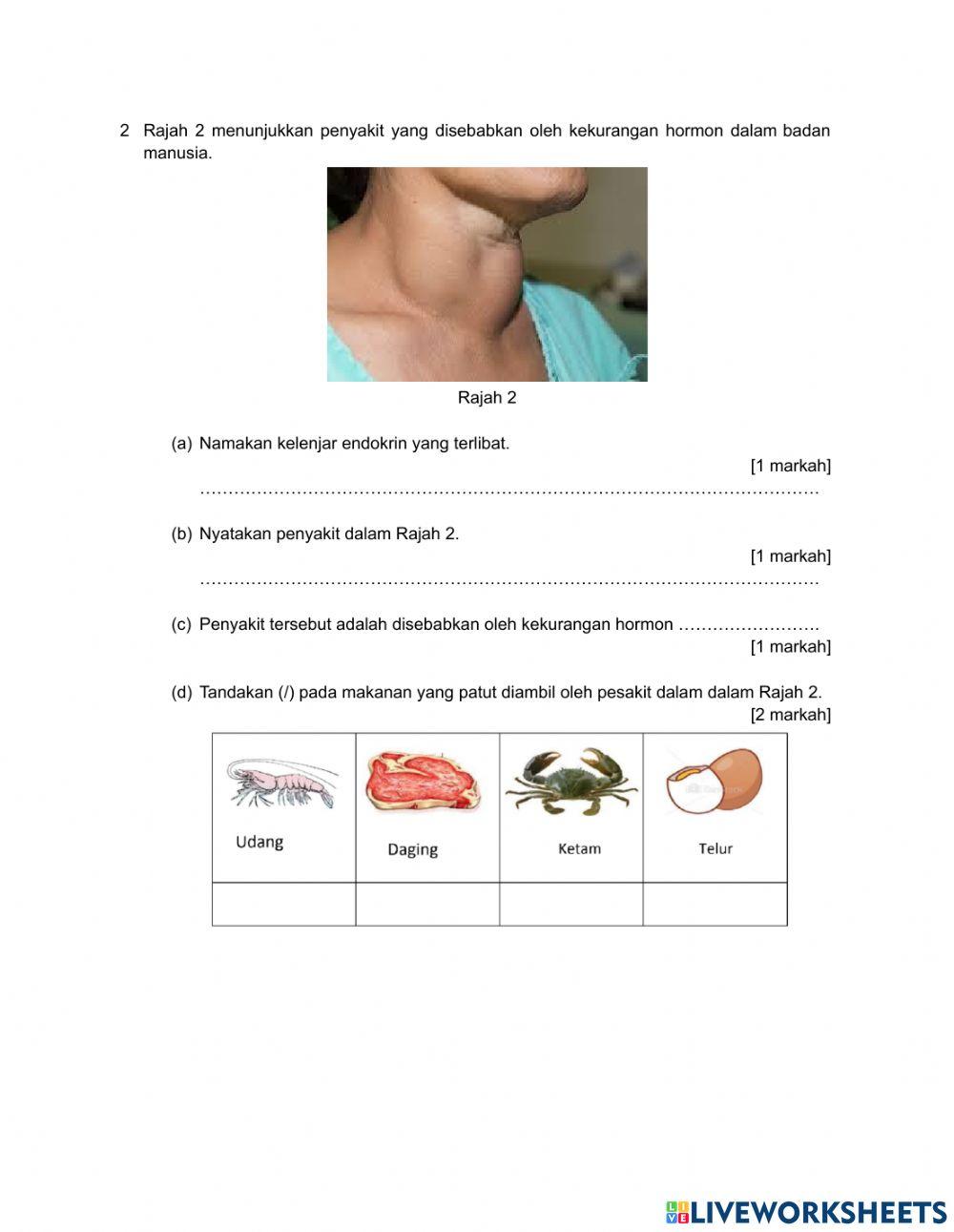 Modul 7.1 Sistem Endokrin Manusia
