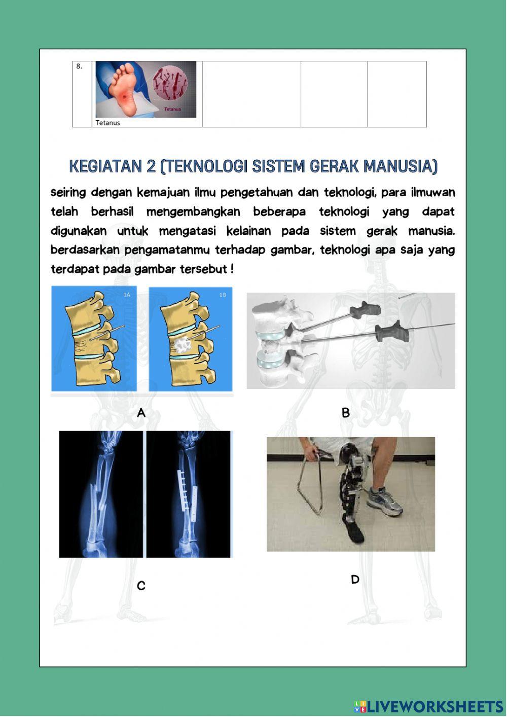 Lembar kerja peserta didik gangguan dan kelainan pada sistem gerak manusia