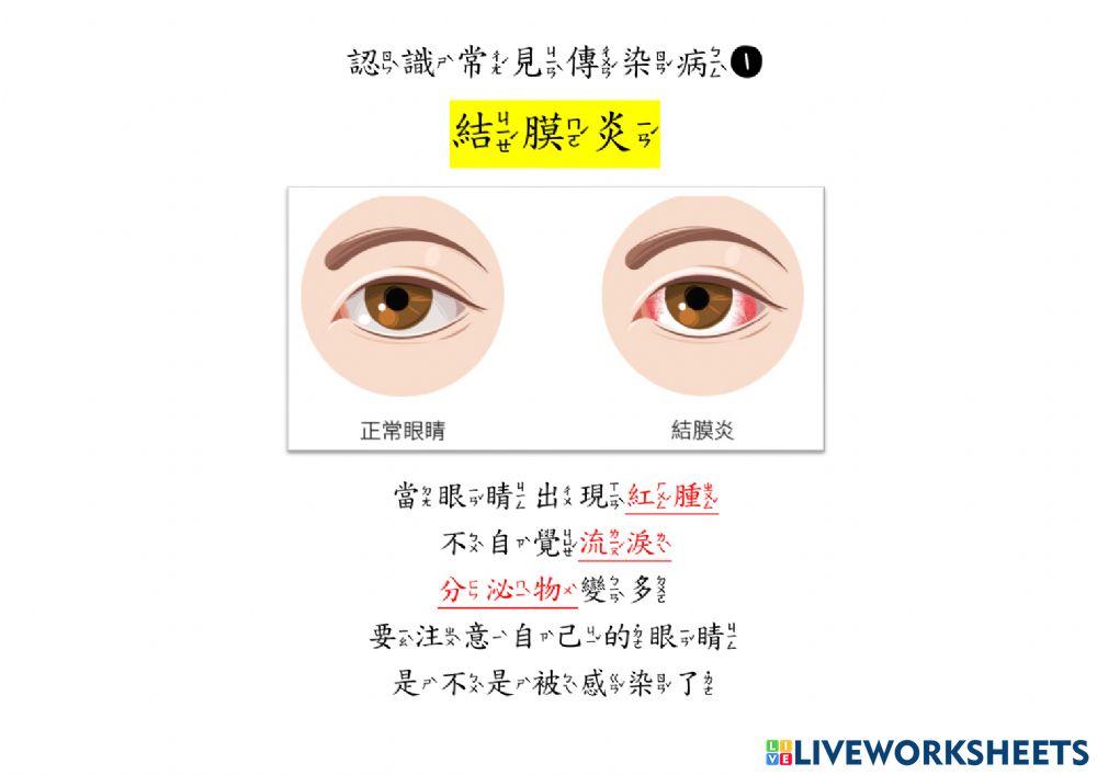 常見傳染病：結膜炎