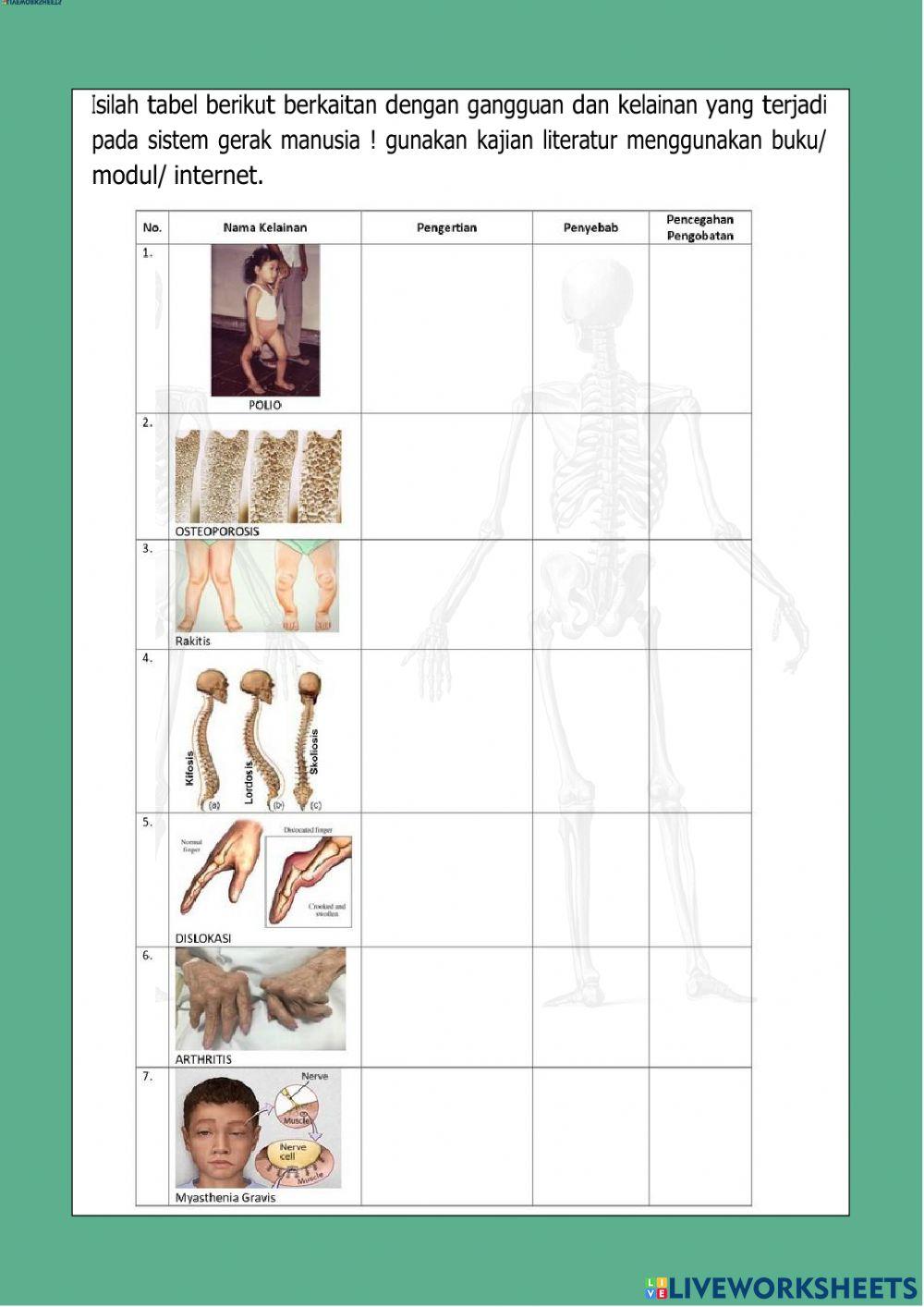 Kelaian Pada Sistem Gerak