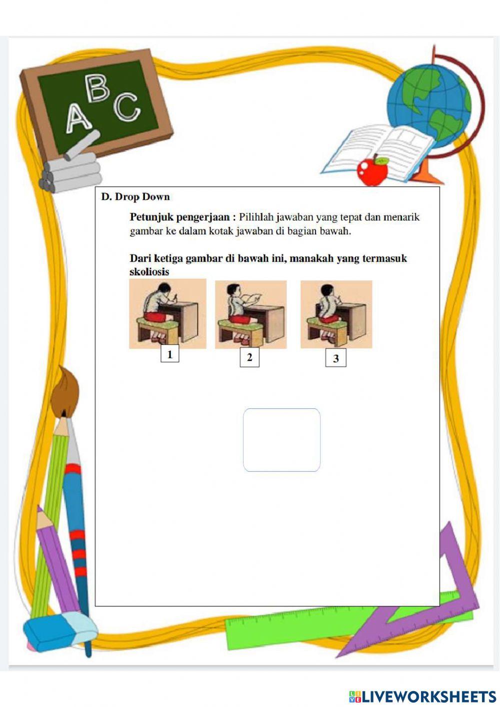 Kelainan Organ gerak Manusia