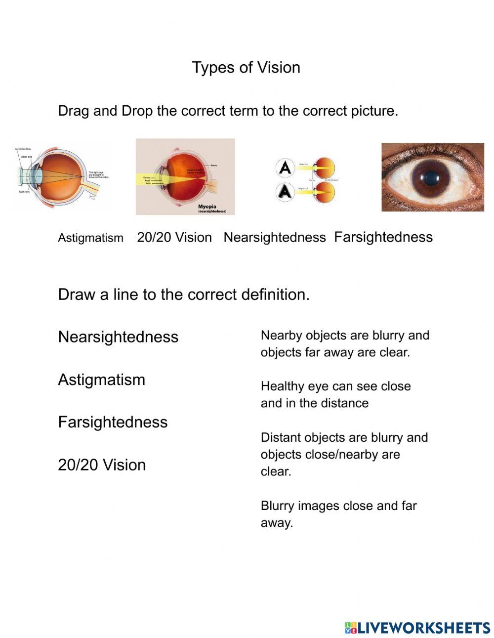 Types of Vision