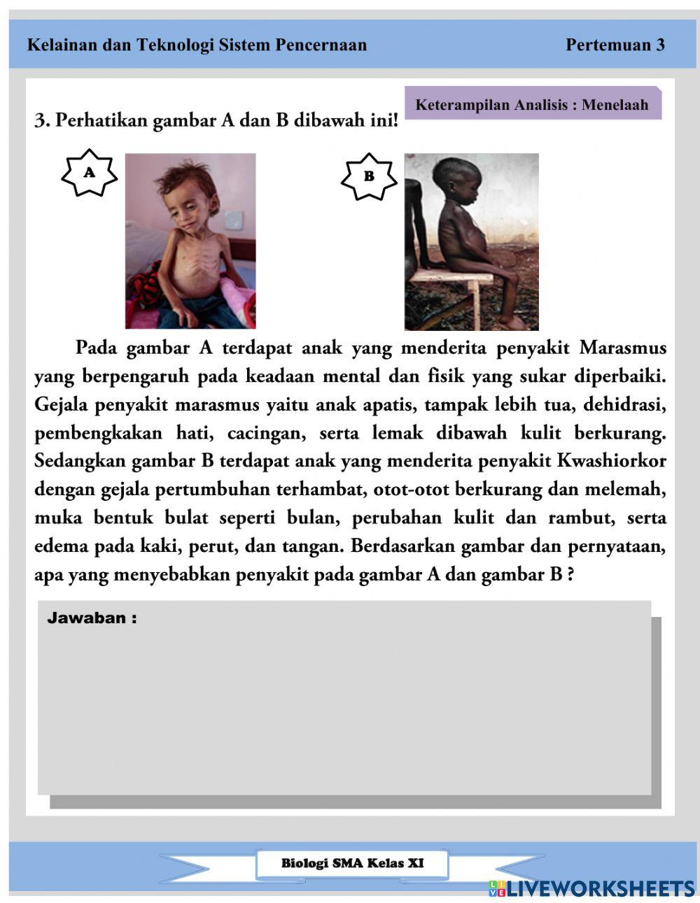 Lkpd pertemuan 3 sistem pencernaan