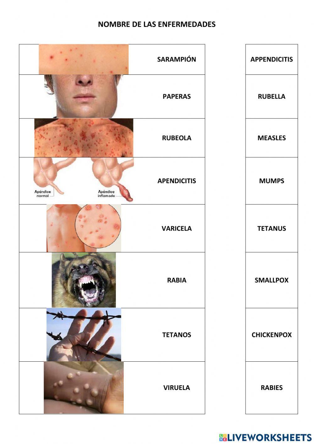 ALCE B1.2 U7S1 Nombres enfermedades