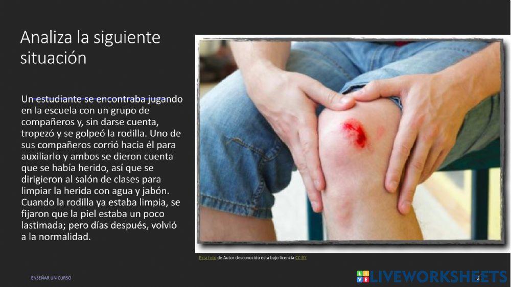 Los tejidos anilames