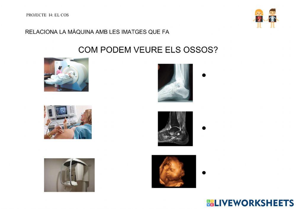 Com podem veure els ossos